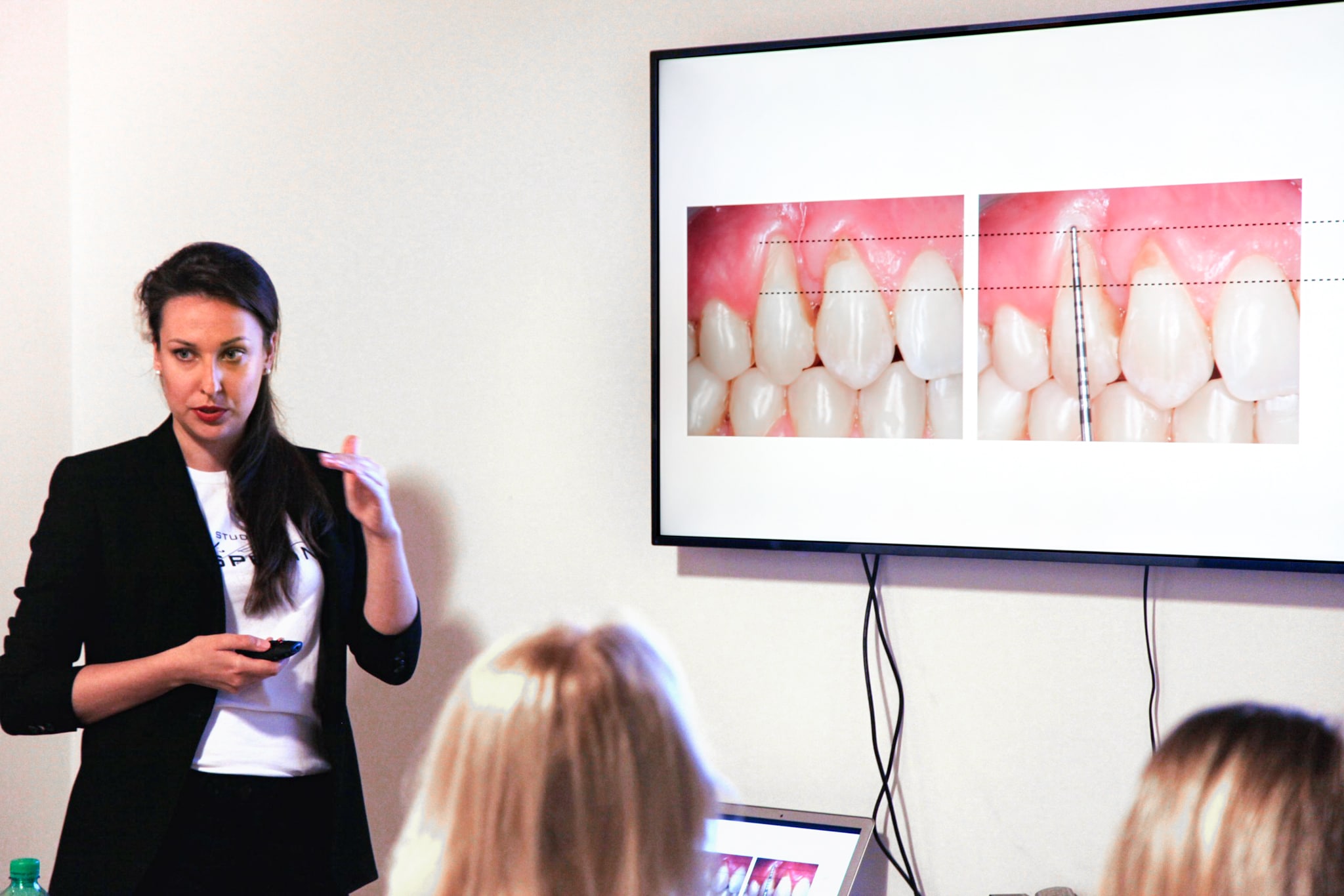 Angelina Gorbunkova courses perio periodontology for hygienists cosri parodontologia per gli igienisti