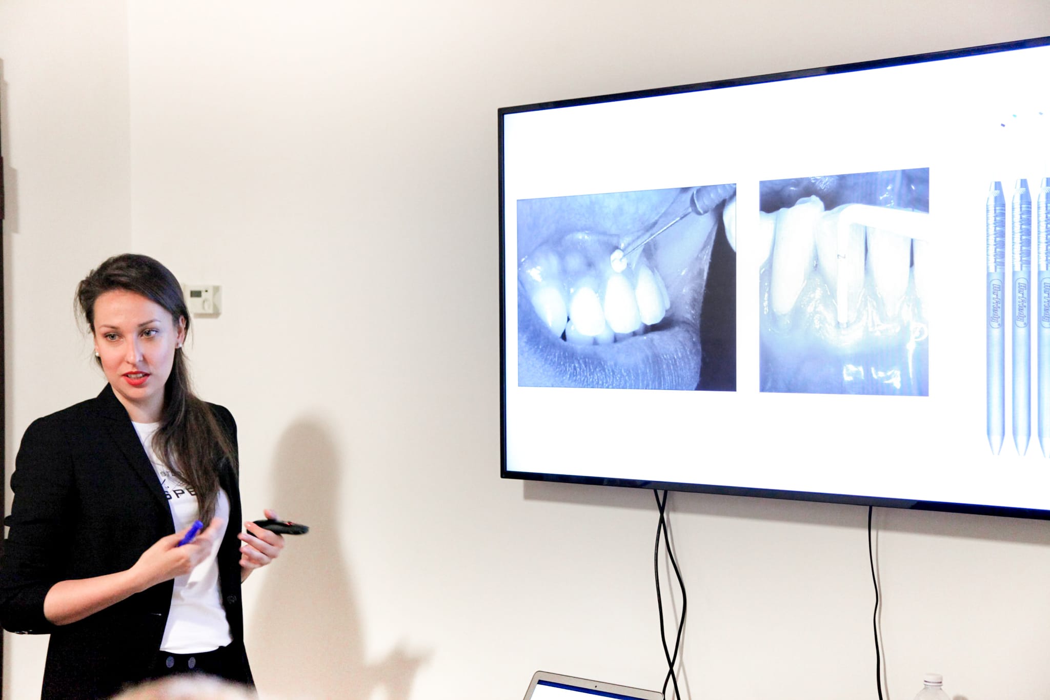 Angelina Gorbunkova courses perio periodontology for hygienists cosri parodontologia per gli igienisti