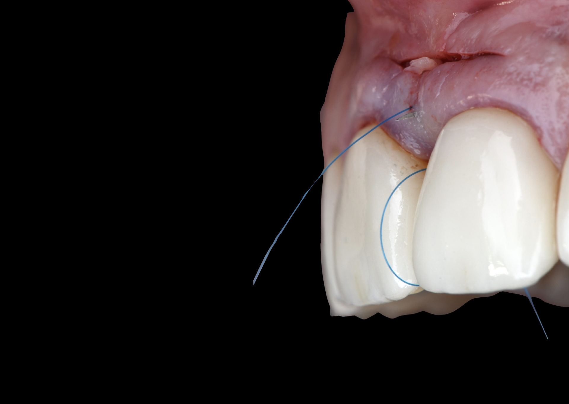 Perio surgical course rasperini education