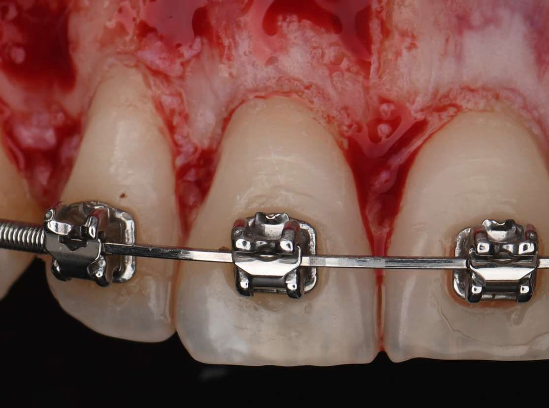 Periodontal surgical course rasperini education